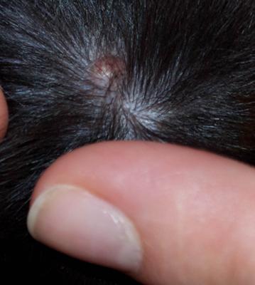 what causes small bumps on dogs back